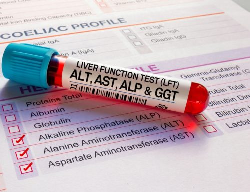 When Does an Elevated Liver Enzyme Need More Than a Recheck?